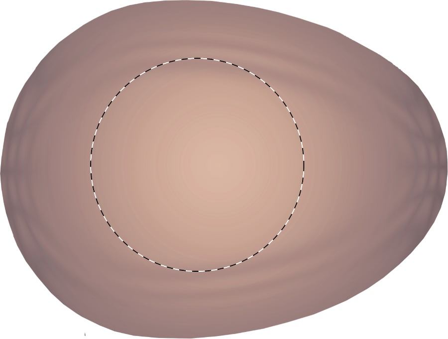 tampondruk (Ø 30 mm)